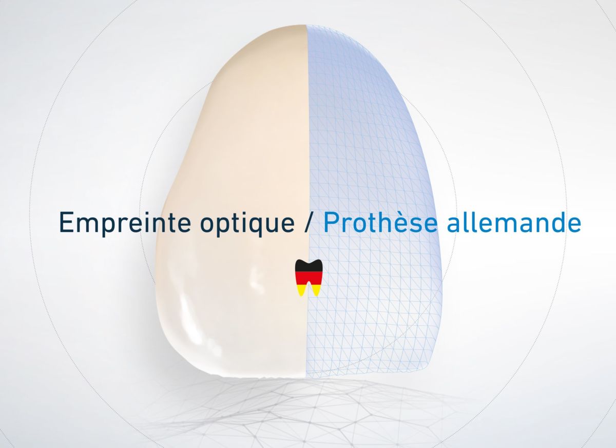 Fabrication allemande pour vos prises d’empreinte optique : rigoureux jusqu’au bout !