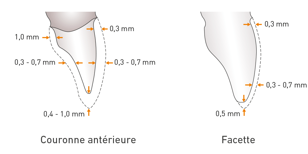 Dents épaisseur