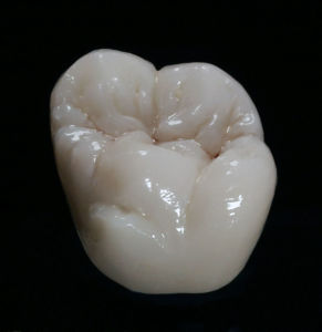 Monolithique Zircone FORMA MonoZir Labocast