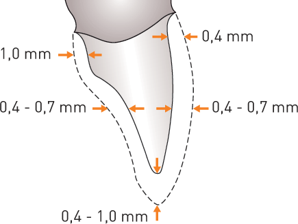 Monozir Ultra schema préparation