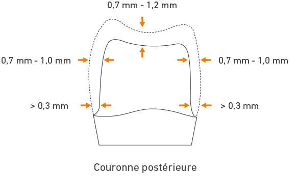 couronne postérieure