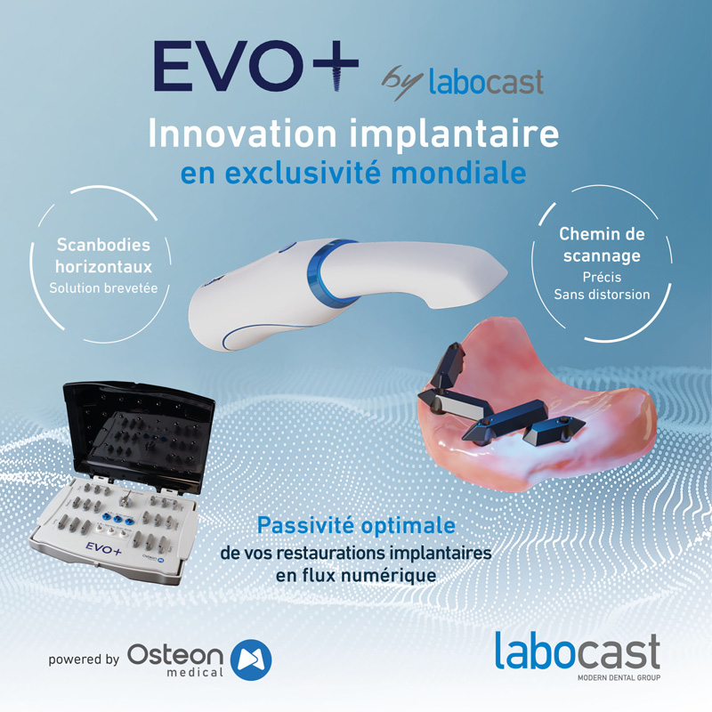 LABOCAST EVO+ Jauges de numérisation