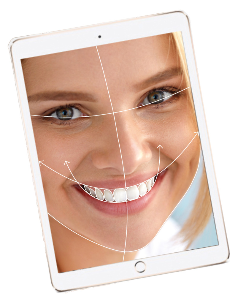 Smile-design Diagnostic approfondi, esthétique et fonctionnel