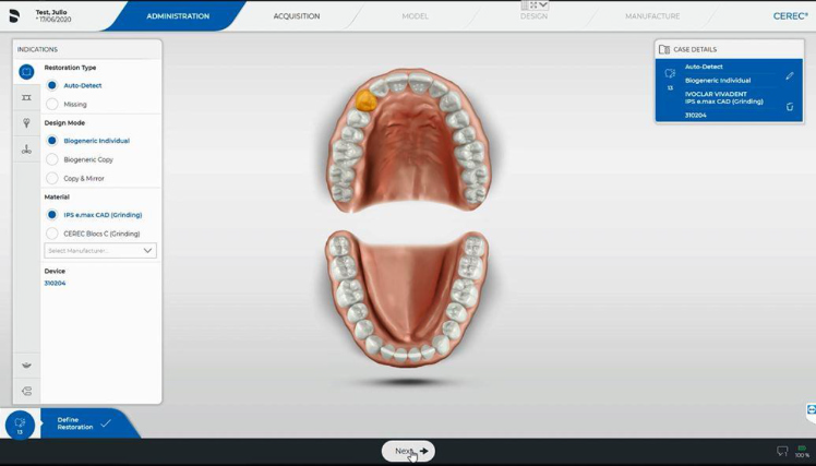 Protocole de scannage Cerec - Partie A étape 2 Cerec : Choisissez une dent et définissez la restauration