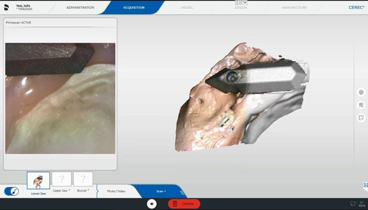 Protocole de scannage Cerec - Partie B étape 3 Cerec : Scannez les jauges DE DROITE à GAUCHE dans un MOUVEMENT CONTINU