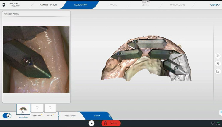 Protocole de scannage Cerec - Partie B étape 4 Cerec : Assurez-vous que toutes les données aient été correctement enregistrées