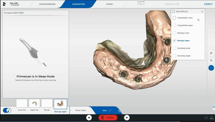 Protocole de scannage Cerec - Partie C étape 3 Cerec : Réalisez le scan de la muqueuse en bouche