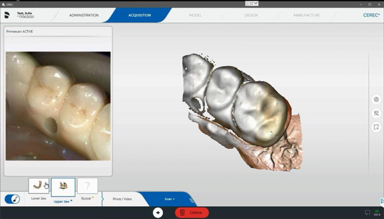 Protocole de scannage Cerec - Partie A étape 4 Cerec : Sélectionnez Arcade du Haut et démarrez le scan