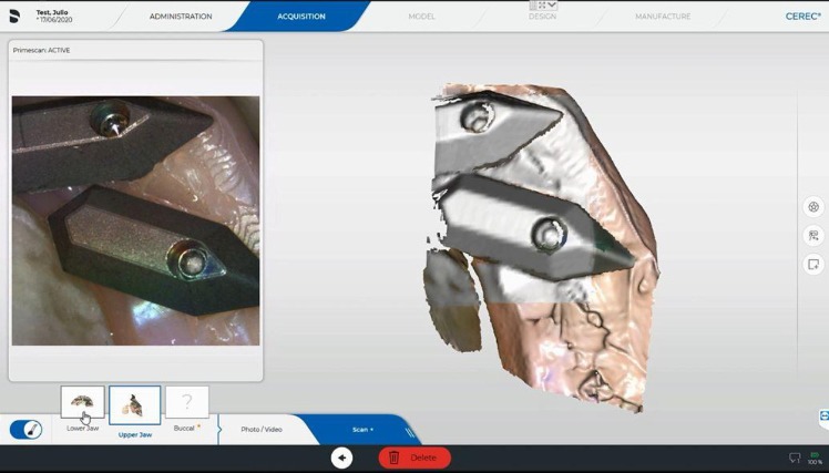 Protocole de scannage Cerec - Partie B étape 5 Cerec : Sélectionnez la fenêtre de l’arcade suivant afin de commencer le scan. Scannez de GAUCHE à DROITE les jauges dans un MOUVEMENT CONTINU