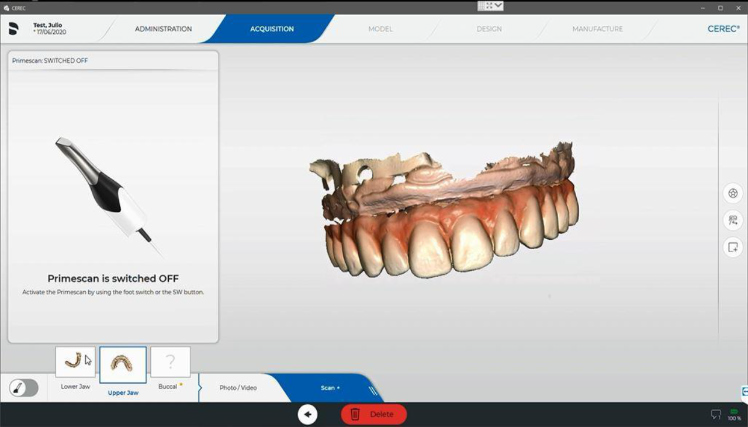 Protocole de scannage Cerec - Partie A étape 5 Cerec : Terminez votre empreinte et vérifiez que toutes les données ont été enregistrées correctement