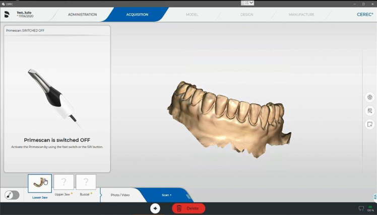 Protocole de scannage Cerec - Partie A étape 7 Cerec : Terminer l’empreinte du bas et vérifiez que toutes les données ont été enregistrées correctement