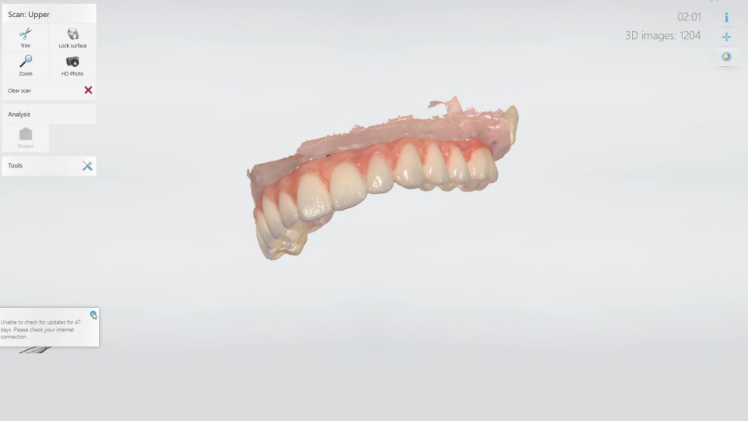Protocole de scannage 3Shape - Partie A étape 4 3Shape : Vérifiez le scan et continuez