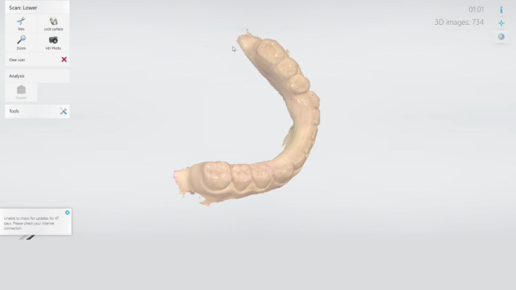 Protocole de scannage 3Shape - Partie A étape 7 3Shape : Vérifiez le scan et continuez
