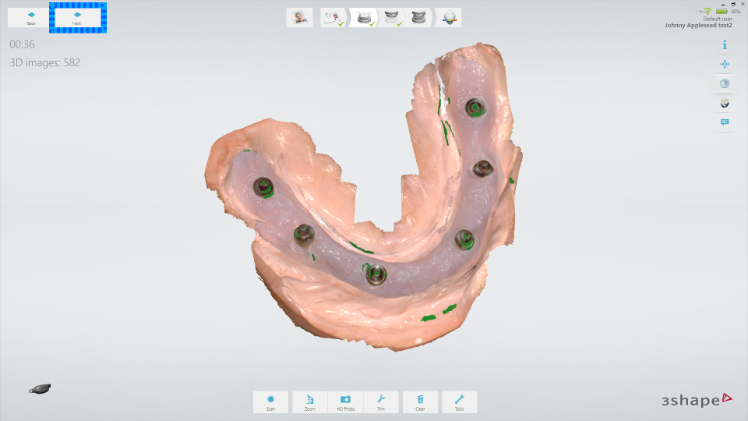 Protocole de scannage 3Shape - Partie C étape 4 3Shape : Vérifiez le scan et continuez