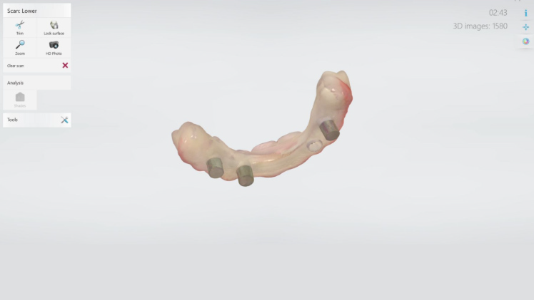 Protocole de scannage 3Shape - Partie C étape 7 3Shape : Vérifiez le scan et continuez