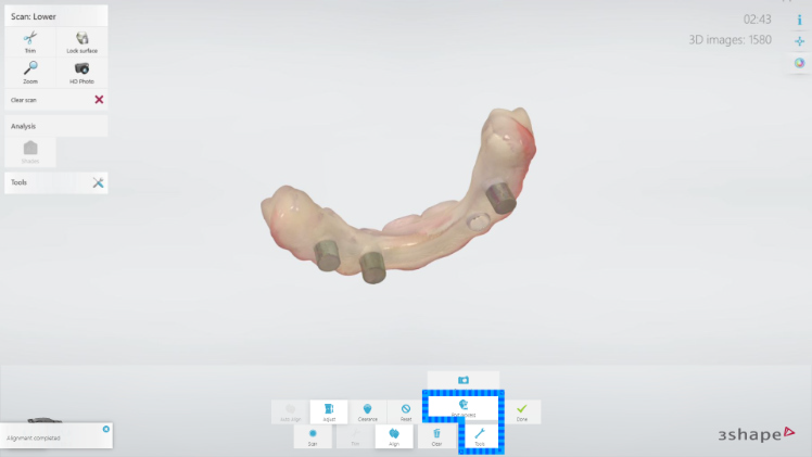 Protocole de scannage 3Shape - Partie C étape 9 3Shape : Ne scannez pas l’occlusion