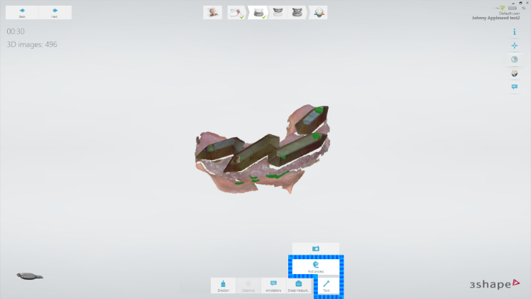 Protocole de scannage 3Shape - Partie B étape 9 3Shape : Ne scannez pas l’occlusion