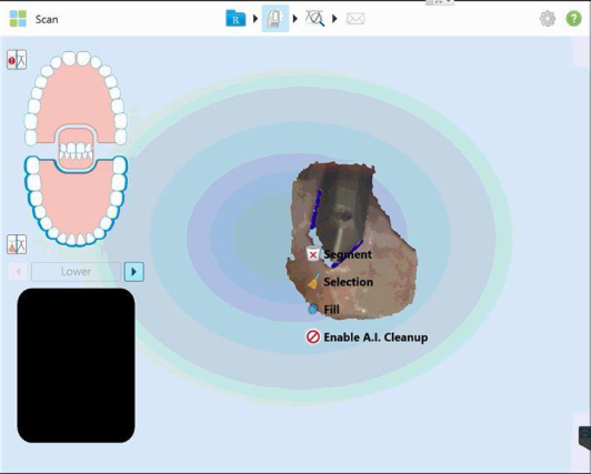 Protocole de scannage iTero - Partie B étape 2 iTero : Désactivez l’Intelligence Artificielle pour le nettoyage avant de démarrer le scan