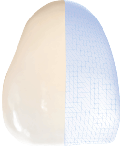 dent-filaire-monolithique-zircone-ultra dent filaire monolithique zircone ultra