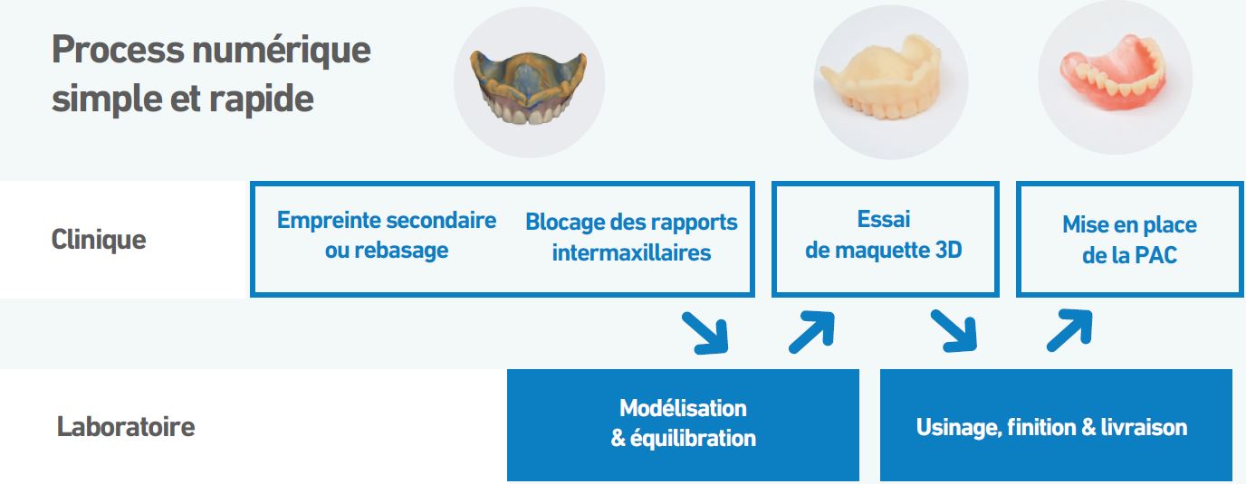 Evo Fusion numérisation dentaire